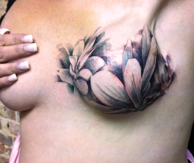 Mastectomy magnolias