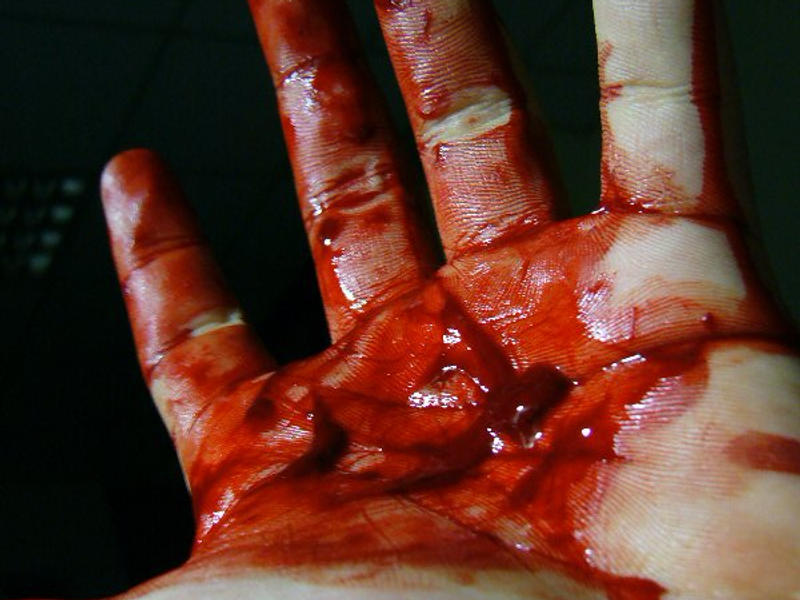 Bloody_Hand___2006_by_Bird26.jpg